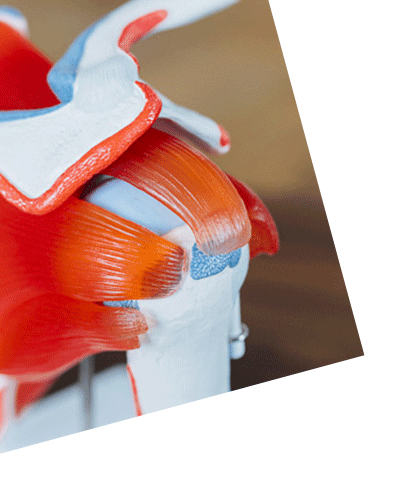 Anatomisches Schultermodell zur Erklärung des Ablaufs und der postoperativen Betreuung nach einer Schulterarthroskopie bei OMOCURA