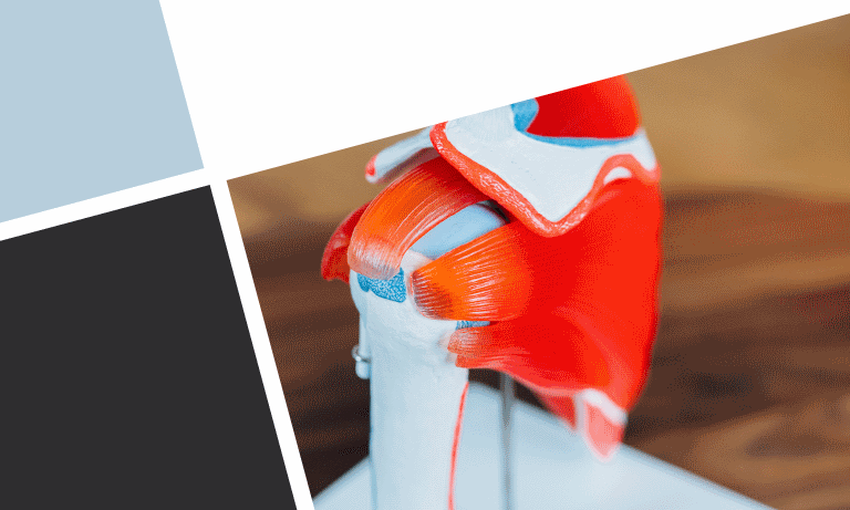 Anatomisches Schultermodell mit Darstellung der Rotatorenmanschette zur Veranschaulichung moderner Schulterchirurgie bei OMOCURA.