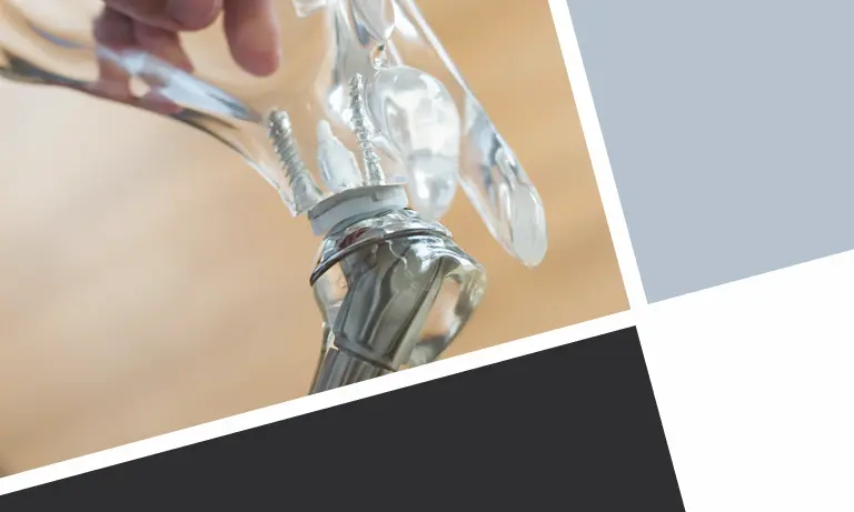 Moderne Schulterprothese im anatomischen Modell als Symbol für innovative Schulterendoprothetik bei OMOCURA.